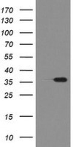 RFC2 Mouse anti-Human, Clone: OTI5A1, lyophilized, TrueMAB 100 &mu;g; Unconjugated:Antibodies,