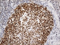 RFC3 Monoclonal Antibody (OTI3F6), TrueMAB , OriGene:Antibodies:Primary