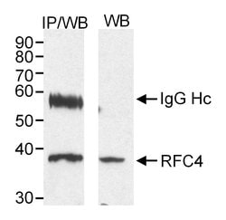 RFC4 Rabbit anti-Human, Polyclonal, Bethyl Laboratories 100 &mu;L; Unconjugated:Antibodies,