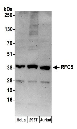 RFC5 Goat anti-Human, Polyclonal, Bethyl Laboratories 10 &mu;L; Unconjugated:Antibodies,