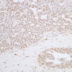 RFX1 Rabbit anti-Human, Mouse, Polyclonal, Bethyl Laboratories 100 &mu;L;