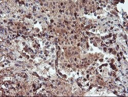 RFXANK Mouse anti-Human, Clone: OTI3F5, lyophilized, TrueMAB 100 &mu;g;