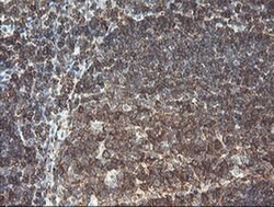 RFXANK Monoclonal Antibody (OTI3F5), TrueMAB , OriGene:Antibodies:Primary