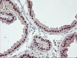 RFXANK Monoclonal Antibody (OTI2F12), TrueMAB , OriGene 30 &mu;L; Unconjugated:Antibodies,