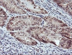 RFXANK Monoclonal Antibody (OTI2F12), TrueMAB , OriGene 30 &mu;L; Unconjugated:Antibodies,