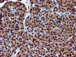 RFXANK Mouse anti-Human, Clone: OTI2B6, liquid, TrueMAB 100 &mu;L; Unconjugated:Antibodies,