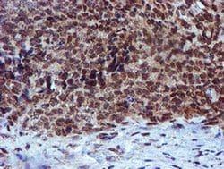 RFXANK Mouse anti-Human, Clone: OTI2B6, liquid, TrueMAB 100 &mu;L; Unconjugated:Antibodies,