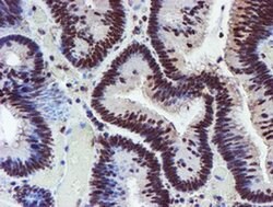 RFXANK Mouse anti-Human, Clone: OTI2B6, liquid, TrueMAB 100 &mu;L; Unconjugated:Antibodies,