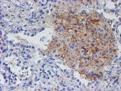 RFXANK Monoclonal Antibody (OTI2C6), TrueMAB , OriGene 100 &mu;L; Unconjugated:Antibodies,