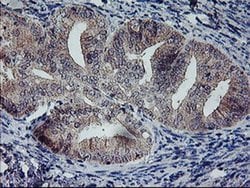RFXANK Monoclonal Antibody (OTI2G7), TrueMAB , OriGene 30 &mu;L; Unconjugated:Antibodies,
