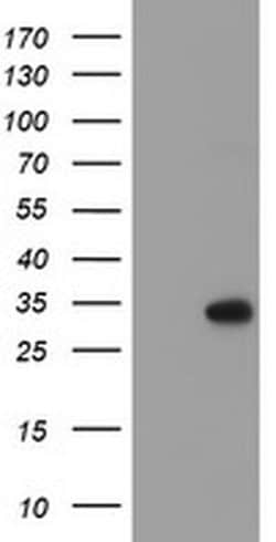 RFXANK Monoclonal Antibody (OTI3C10), TrueMAB , OriGene 100 &mu;L; Unconjugated:Antibodies,