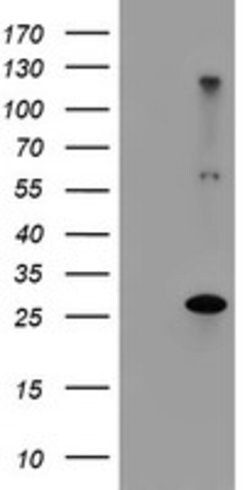 RFXANK Mouse anti-Human, Clone: OTI3B4, lyophilized, TrueMAB 100 &mu;g;
