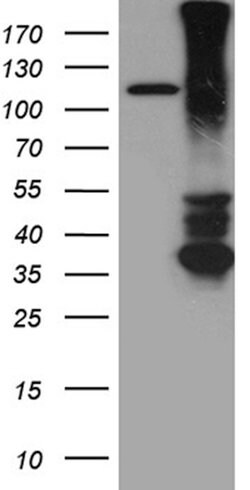RGMA Mouse anti-Human, Clone: OTI1C5, lyophilized, TrueMAB 100 &mu;g; Unconjugated:Antibodies,