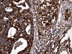 RGS10 Monoclonal Antibody (OTI1B10), TrueMAB , OriGene 100 &mu;L; Unconjugated:Antibodies,