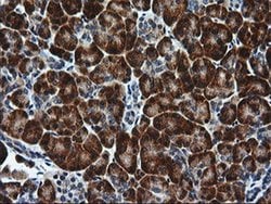RGS16 Monoclonal Antibody (OTI1F3), TrueMAB , OriGene 100 &mu;L; Unconjugated:Antibodies,