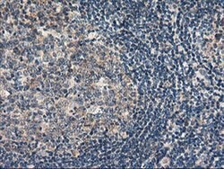 RGS16 Monoclonal Antibody (OTI1F3), TrueMAB , OriGene 100 &mu;L; Unconjugated:Antibodies,