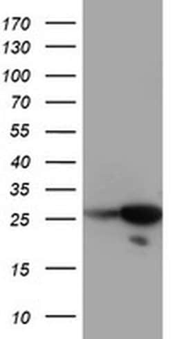 RGS16 Monoclonal Antibody (OTI1H7), TrueMAB , OriGene 100 &mu;L; Unconjugated:Antibodies,