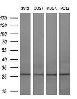 RGS16 Mouse anti-Human, Clone: OTI1H7, lyophilized, TrueMAB 100 &mu;g | Buy Online | OriGene | Fisher Scientific