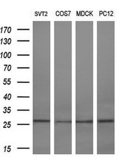 RGS16 Monoclonal Antibody (OTI1H7), TrueMAB , OriGene 100 &mu;L; Unconjugated:Antibodies,
