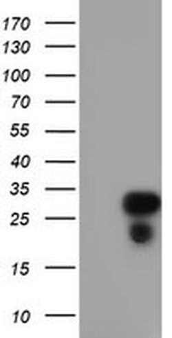 RGS16 Monoclonal Antibody (OTI4C9), TrueMAB , OriGene 30 &mu;L | Buy Online | Origene Technologies | Fisher Scientific