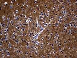 RGS17 Monoclonal Antibody (OTI8G4), TrueMAB , OriGene 100 &mu;L; Unconjugated:Antibodies,