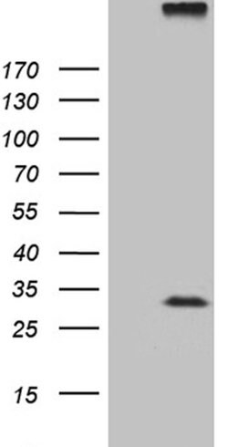 RGS17 Mouse anti-Human, Clone: OTI9G4, lyophilized, TrueMAB 100 &mu;g;