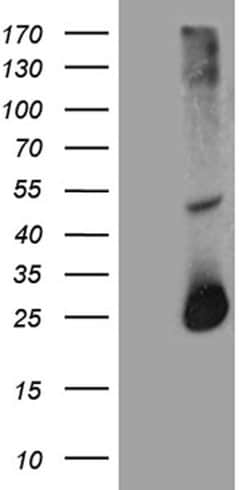 RGS17 Mouse anti-Human, Clone: OTI8G4, lyophilized, TrueMAB 100 &mu;g;