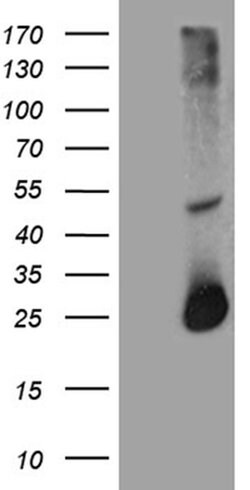 RGS17 Monoclonal Antibody (OTI8G4), TrueMAB , OriGene 100 &mu;L; Unconjugated:Antibodies,