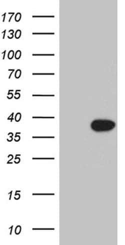 RGS18 Monoclonal Antibody (OTI8C8), TrueMAB , OriGene 30 &mu;L; Unconjugated:Antibodies,