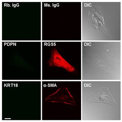 RGS5 Mouse anti-Human, Clone: OTI1C1, lyophilized, TrueMAB 100 &mu;g; Unconjugated:Antibodies,