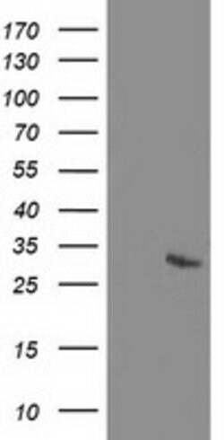 RGS5 Mouse anti-Human, Clone: OTI 3H6, lyophilized, TrueMAB 100 &mu;g | Buy Online | Origene Technologies | Fisher Scientific