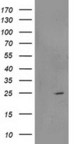 RGS5 Mouse anti-Human, Clone: OTI1C1, lyophilized, TrueMAB 100 &mu;g; Unconjugated:Antibodies,