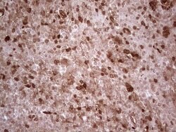 RHOC Monoclonal Antibody (OTI3A5), TrueMAB , OriGene 100 &mu;L; Unconjugated:Antibodies,
