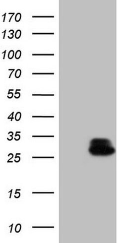 RHOC Monoclonal Antibody (OTI3C6), TrueMAB , OriGene:Antibodies:Primary