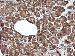 RHOJ Monoclonal Antibody (OTI1A9), TrueMAB , OriGene 100 &mu;L; Unconjugated:Antibodies,