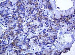 RHOJ Monoclonal Antibody (OTI1A9), TrueMAB , OriGene 100 &mu;L; Unconjugated:Antibodies,