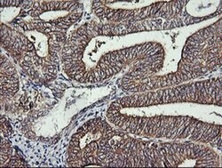 RHOJ Monoclonal Antibody (OTI1A9), TrueMAB , OriGene 100 &mu;L; Unconjugated:Antibodies,