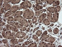 RHOJ Mouse anti-Human, Clone: OTI1D7, lyophilized, TrueMAB 100 &mu;g; Unconjugated:Antibodies,