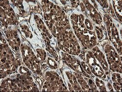 RHOJ Mouse anti-Human, Clone: OTI1D7, lyophilized, TrueMAB 100 &mu;g; Unconjugated:Antibodies,