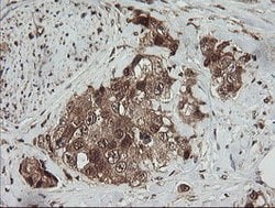 RHOJ Mouse anti-Human, Clone: OTI1D7, lyophilized, TrueMAB 100 &mu;g; Unconjugated:Antibodies,