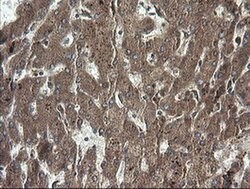 RHOJ Monoclonal Antibody (OTI1D7), TrueMAB , OriGene 30 &mu;L; Unconjugated:Antibodies,
