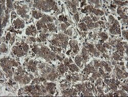 RHOJ Mouse anti-Human, Clone: OTI1D7, lyophilized, TrueMAB 100 &mu;g; Unconjugated:Antibodies,
