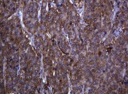 RHOJ Monoclonal Antibody (OTI5C7), TrueMAB , OriGene 30 &mu;L; Unconjugated:Antibodies,