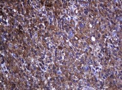 RHOJ Monoclonal Antibody (OTI5C7), TrueMAB , OriGene 30 &mu;L; Unconjugated:Antibodies,