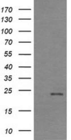 RHOJ Mouse anti-Human, Clone: OTI2C10, lyophilized, TrueMAB 100 &mu;g;