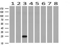 RHOJ Mouse anti-Human, Clone: OTI2C10, lyophilized, TrueMAB 100 &mu;g;