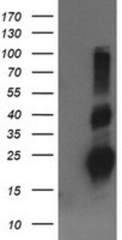 RHOJ Mouse anti-Human, Clone: OTI1D7, lyophilized, TrueMAB 100 &mu;g; Unconjugated:Antibodies,