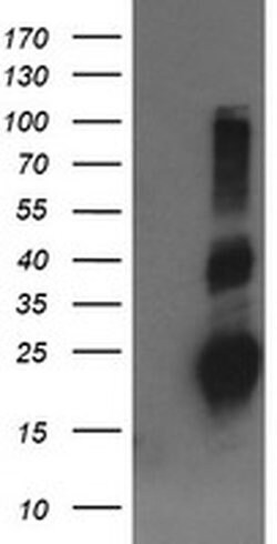 RHOJ Monoclonal Antibody (OTI1D7), TrueMAB , OriGene 30 &mu;L; Unconjugated:Antibodies,