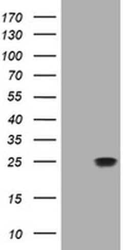 RHOJ Monoclonal Antibody (OTI5C7), TrueMAB , OriGene:Antibodies:Primary