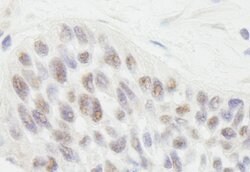 RIF1 Rabbit anti-Human, Polyclonal, Bethyl Laboratories 100 &mu;L; Unconjugated:Antibodies,